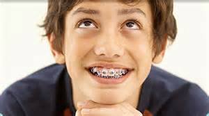 Orthodontics for Children